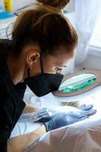 Can the NHS remove Skin Tags?