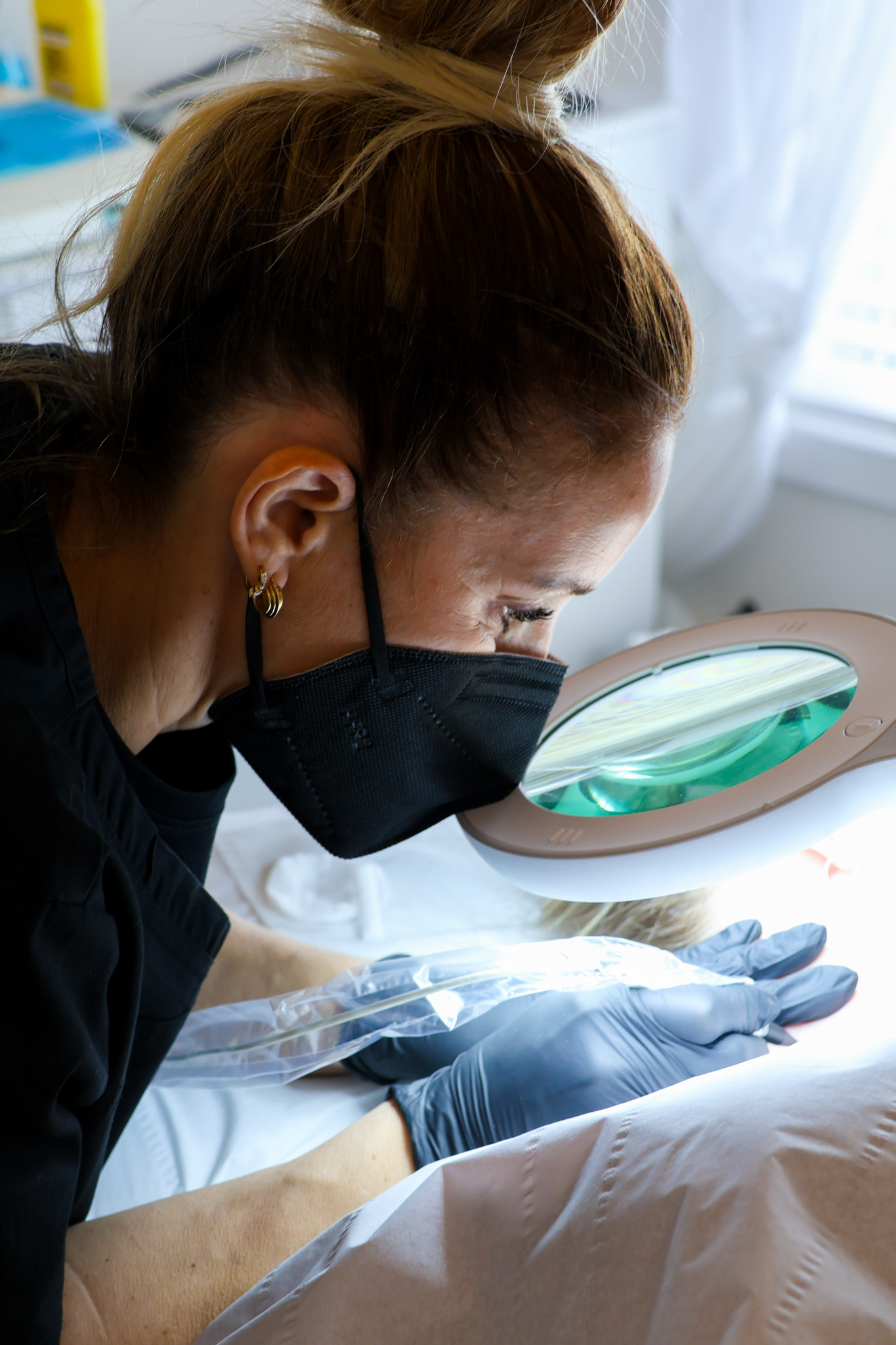 Can the NHS remove Skin Tags?