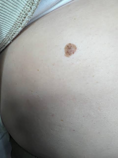 images (8)