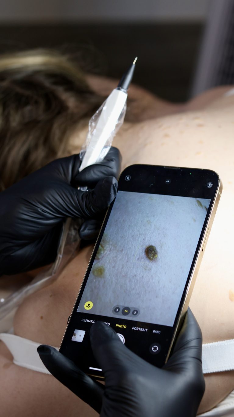 Mole checking service